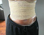 DIY: Lose Weight Body Wraps to Shed Unwanted Pounds